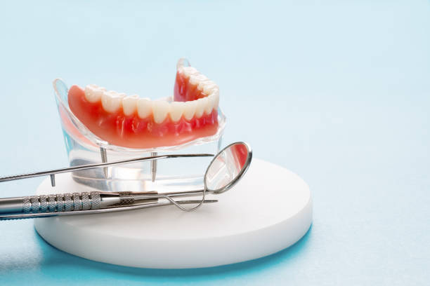 Best Wisdom Tooth Removal  in Massillon, OH